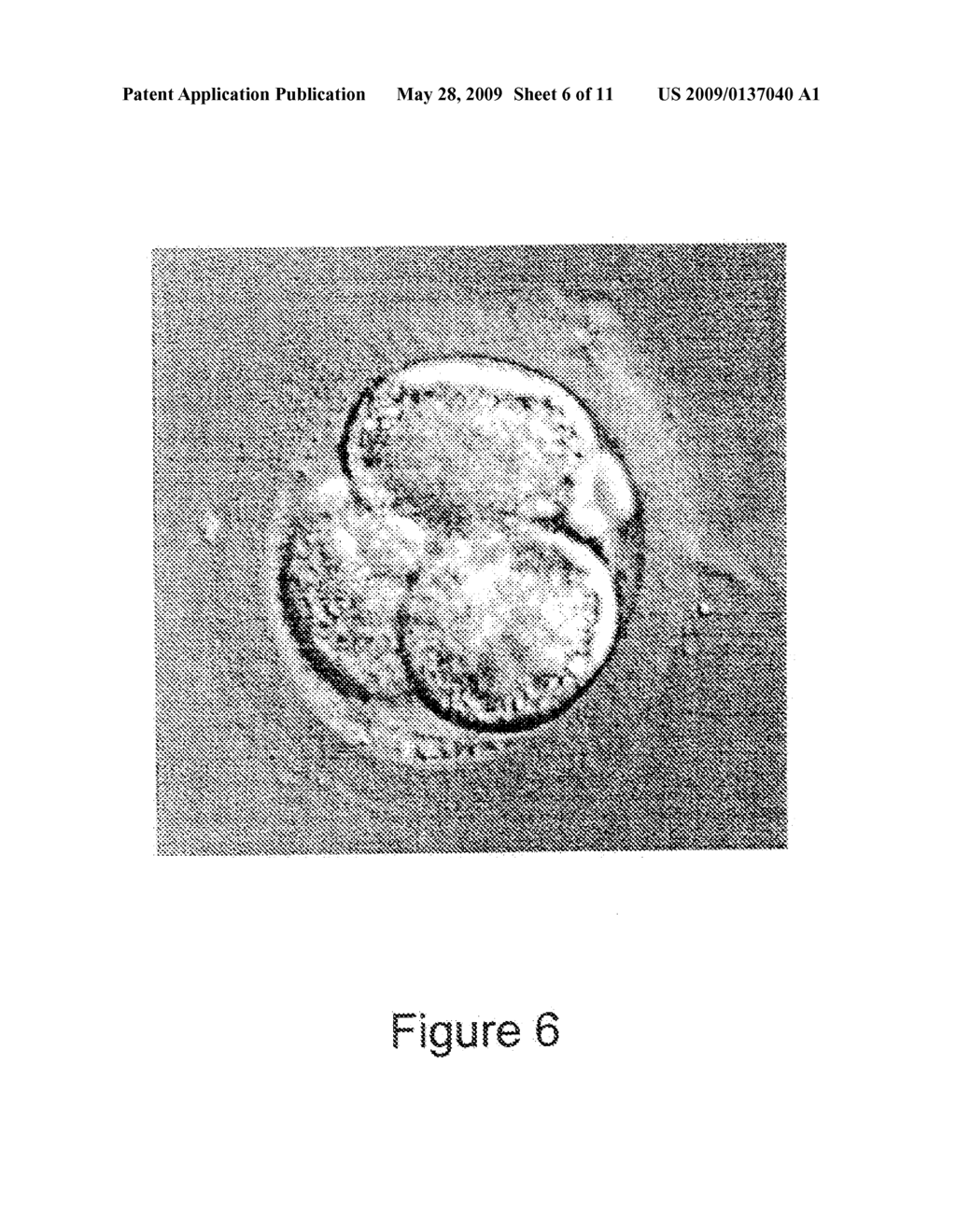 METHODS FOR MAKING AND USING REPROGRAMMED HUMAN SOMATIC CELL NUCLEI AND AUTOLOGOUS AND ISOGENIC HUMAN STEM CELLS - diagram, schematic, and image 07