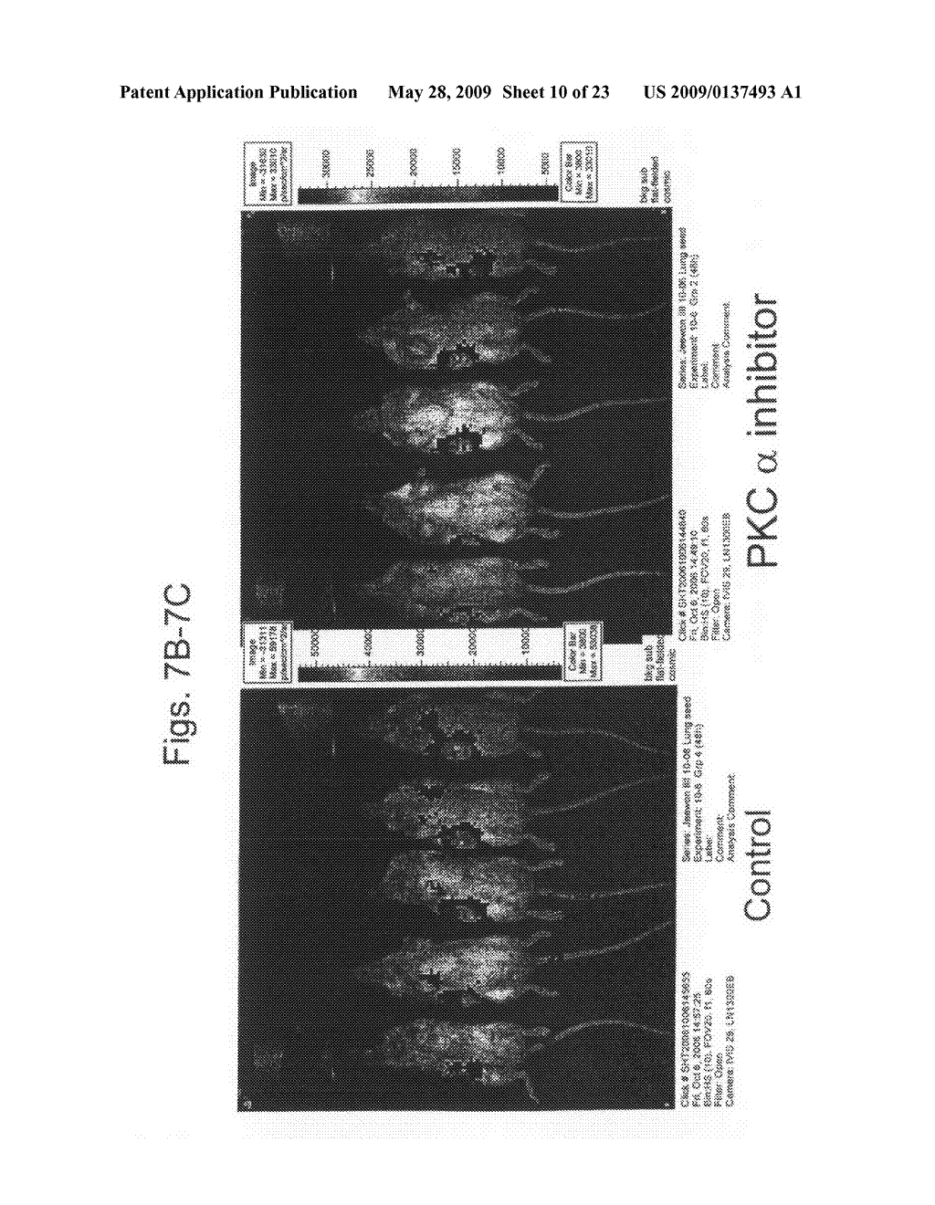 Inhibition of tumor metastases using protein kinase C (PKC) inhibitors - diagram, schematic, and image 11