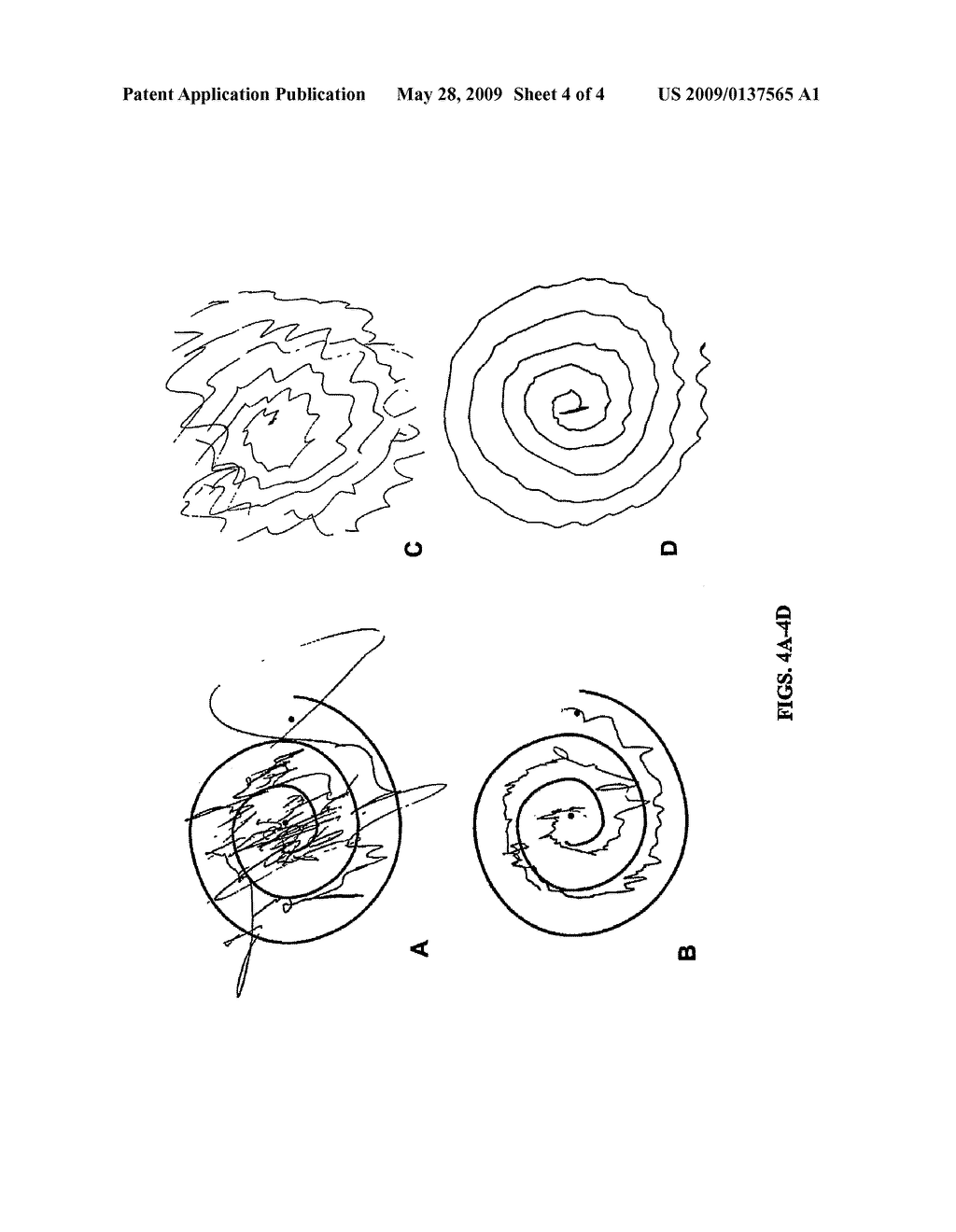 Method for treatment of movement disorders - diagram, schematic, and image 05