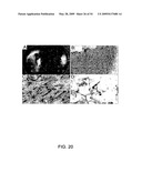 NOVEL NON-SELECTIVE CATION CHANNEL IN NEURONAL CELLS AND METHOD FOR TREATING BRAIN SWELLING diagram and image