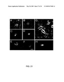 NOVEL NON-SELECTIVE CATION CHANNEL IN NEURONAL CELLS AND METHOD FOR TREATING BRAIN SWELLING diagram and image