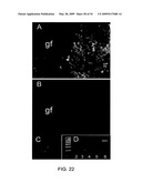 NOVEL NON-SELECTIVE CATION CHANNEL IN NEURONAL CELLS AND METHOD FOR TREATING BRAIN SWELLING diagram and image