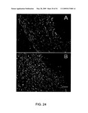 NOVEL NON-SELECTIVE CATION CHANNEL IN NEURONAL CELLS AND METHOD FOR TREATING BRAIN SWELLING diagram and image