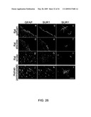 NOVEL NON-SELECTIVE CATION CHANNEL IN NEURONAL CELLS AND METHOD FOR TREATING BRAIN SWELLING diagram and image