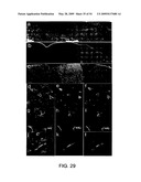 NOVEL NON-SELECTIVE CATION CHANNEL IN NEURONAL CELLS AND METHOD FOR TREATING BRAIN SWELLING diagram and image