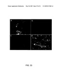 NOVEL NON-SELECTIVE CATION CHANNEL IN NEURONAL CELLS AND METHOD FOR TREATING BRAIN SWELLING diagram and image