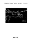 NOVEL NON-SELECTIVE CATION CHANNEL IN NEURONAL CELLS AND METHOD FOR TREATING BRAIN SWELLING diagram and image