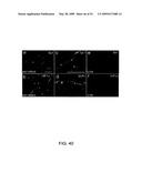 NOVEL NON-SELECTIVE CATION CHANNEL IN NEURONAL CELLS AND METHOD FOR TREATING BRAIN SWELLING diagram and image