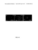 NOVEL NON-SELECTIVE CATION CHANNEL IN NEURONAL CELLS AND METHOD FOR TREATING BRAIN SWELLING diagram and image