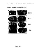 NOVEL NON-SELECTIVE CATION CHANNEL IN NEURONAL CELLS AND METHOD FOR TREATING BRAIN SWELLING diagram and image