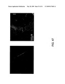 NOVEL NON-SELECTIVE CATION CHANNEL IN NEURONAL CELLS AND METHOD FOR TREATING BRAIN SWELLING diagram and image