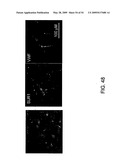 NOVEL NON-SELECTIVE CATION CHANNEL IN NEURONAL CELLS AND METHOD FOR TREATING BRAIN SWELLING diagram and image