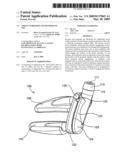 Tissue Stabilizer and Methods of Use diagram and image