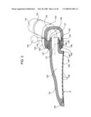 Tissue Stabilizer and Methods of Use diagram and image