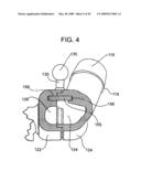 Tissue Stabilizer and Methods of Use diagram and image