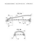 Tissue Stabilizer and Methods of Use diagram and image