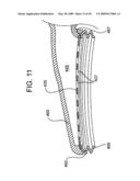 Tissue Stabilizer and Methods of Use diagram and image