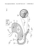 Medical or veterinary digestive tract utilization systems and methods diagram and image