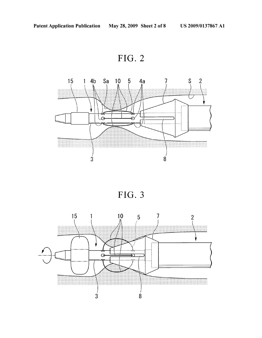 ENDOSCOPE TREATMENT SYSTEM - diagram, schematic, and image 03