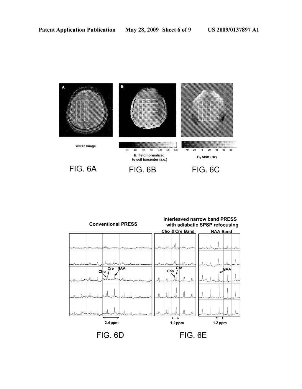 METHOD FOR MAGNETIC RESONANCE SPECTROSCOPIC IMAGING - diagram, schematic, and image 07