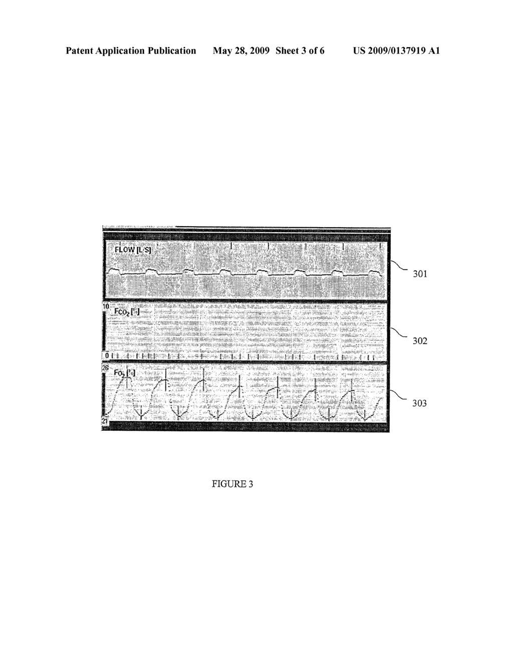 LUNG VOLUME MONITORING METHOD AND DEVICE - diagram, schematic, and image 04