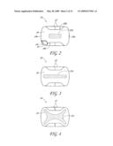 SECUREMENT SYSTEM FOR A MEDICAL ARTICLE diagram and image