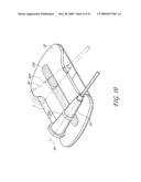 SECUREMENT SYSTEM FOR A MEDICAL ARTICLE diagram and image