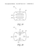 SECUREMENT SYSTEM FOR A MEDICAL ARTICLE diagram and image