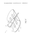 SECUREMENT SYSTEM FOR A MEDICAL ARTICLE diagram and image