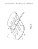 SECUREMENT SYSTEM FOR A MEDICAL ARTICLE diagram and image