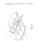 SECUREMENT SYSTEM FOR A MEDICAL ARTICLE diagram and image