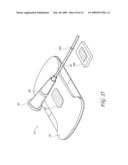 SECUREMENT SYSTEM FOR A MEDICAL ARTICLE diagram and image