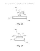 SECUREMENT SYSTEM FOR A MEDICAL ARTICLE diagram and image