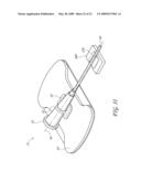 SECUREMENT SYSTEM FOR A MEDICAL ARTICLE diagram and image