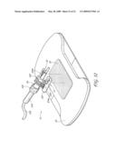 SECUREMENT SYSTEM FOR A MEDICAL ARTICLE diagram and image