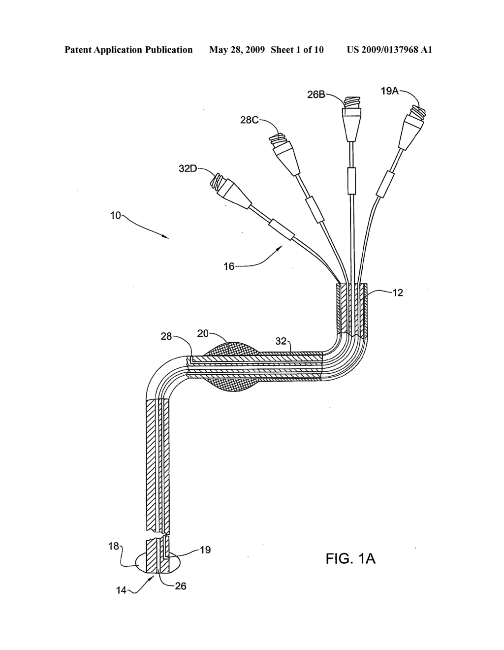 Apparatus for Controlled Blood Regurgitation Through Tricuspid Valve - diagram, schematic, and image 02