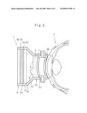 Ophthalmic laser treatment device diagram and image