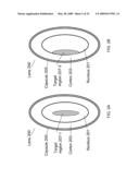 Methods and Apparatus for Laser Treatment of the Crystalline Lens diagram and image