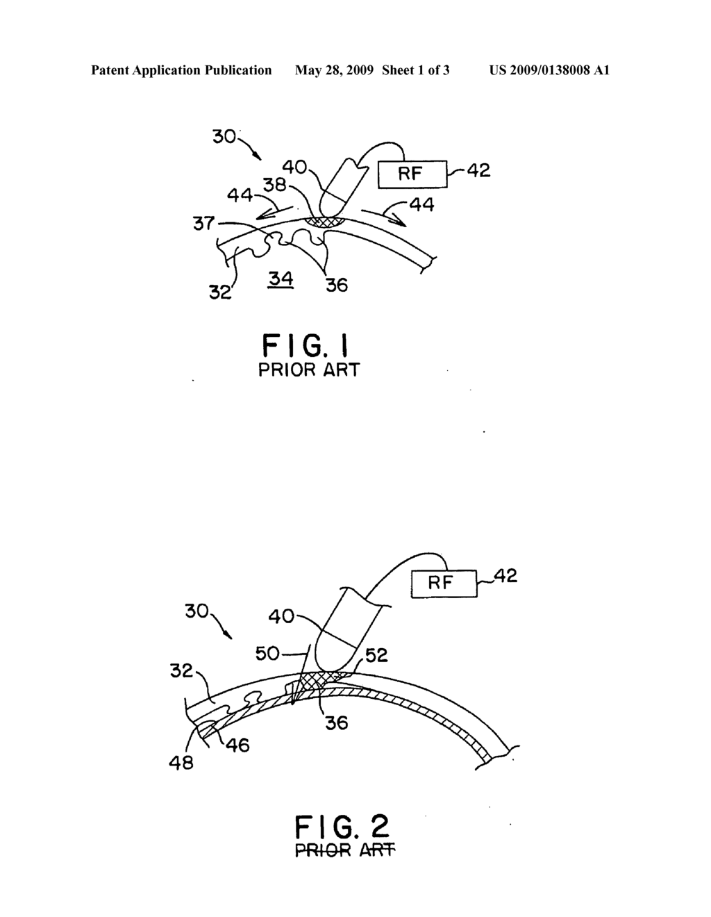 Endocardial Dispersive Electrode for Use with a Monopolar RF Ablation Pen - diagram, schematic, and image 02