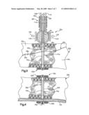 APPARATUS AND METHOD FOR SECURING BONE diagram and image