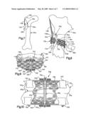 APPARATUS AND METHOD FOR SECURING BONE diagram and image