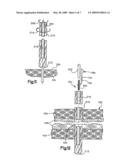 APPARATUS AND METHOD FOR SECURING BONE diagram and image