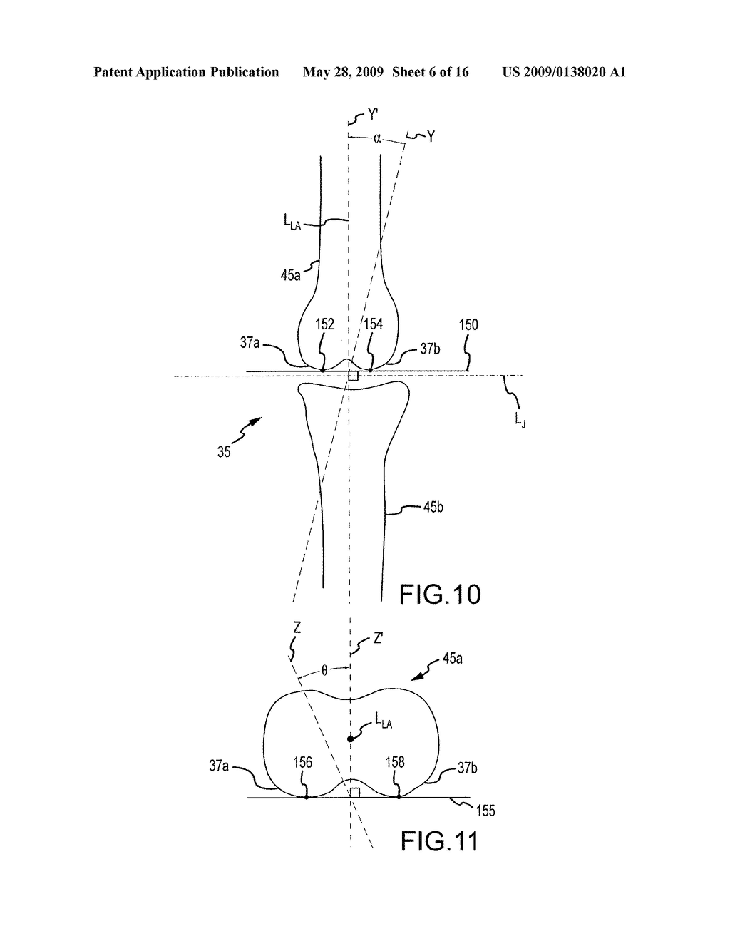 GENERATING MRI IMAGES USABLE FOR THE CREATION OF 3D BONE MODELS EMPLOYED TO MAKE CUSTOMIZED ARTHROPLASTY JIGS - diagram, schematic, and image 07