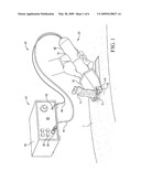 DERMATOME WITH ULTRASONIC CUTTING BLADE diagram and image