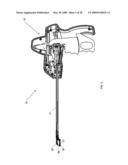 Suture passing instrument and method diagram and image