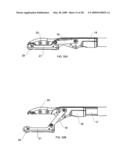 Suture passing instrument and method diagram and image