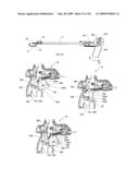 Suture passing instrument and method diagram and image