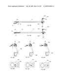 Suture passing instrument and method diagram and image