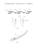 Suture passing instrument and method diagram and image