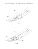 Suture passing instrument and method diagram and image